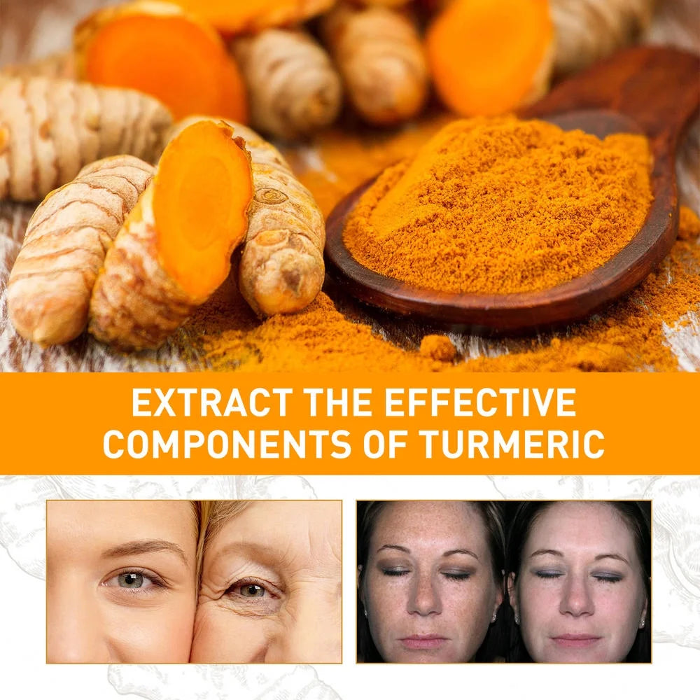 10Ml Turmeric Essential Oil 10Ml Organic Tumeric Oil for Dark Spots Pure Therapeutic